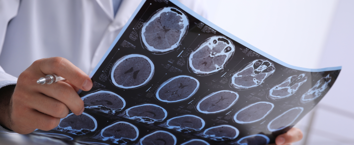 Doctor analyzing a brain scan